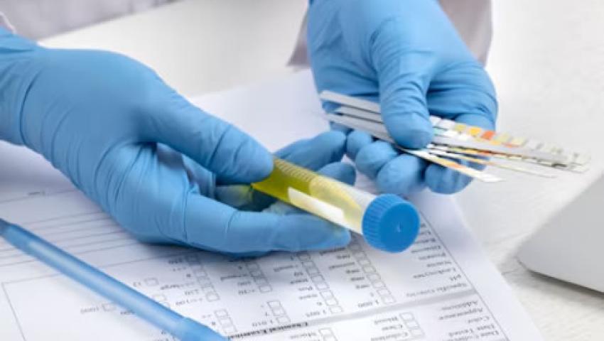 Laboratory Tests